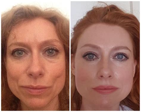face yoga before and after reddit